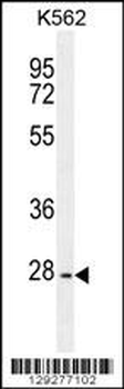 PTPN20A Antibody (Center)