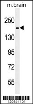 RB1CC1 Antibody (Center)