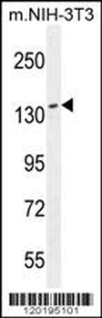 NUP160 Antibody (Center)