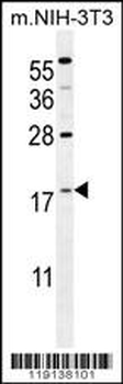 S100A4 Antibody (N-term)