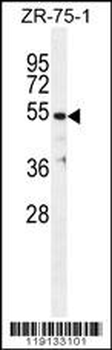TBB1 Antibody (N-term)