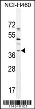 SOX1 Antibody (N-term)