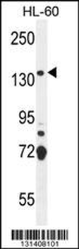 SOS2 Antibody (N-term)