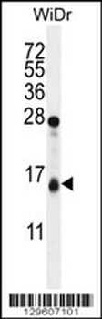 TOMM20L Antibody (N-term)