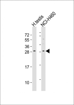LCN9 Antibody (N-term)