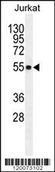 GLUD1 Antibody (C-term)