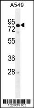 RAD17 Antibody (Center)
