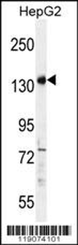 PALB2 Antibody (Center)