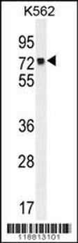 MLH1 Antibody (Center)