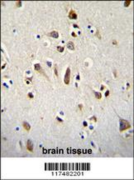 OTX2 Antibody (C-term)