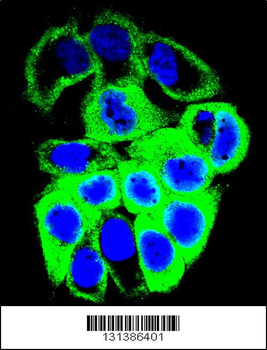 GALNS Antibody (Center)