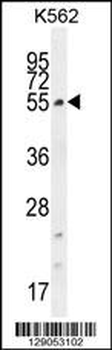 CCDC61 Antibody (N-term)