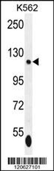 ISWI Antibody (C-term)