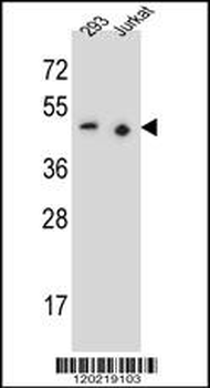 PAX9 Antibody (N-term)