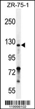 Neuropilin-2 Antibody (C-term K813)