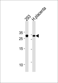 TCF21 Antibody (C-term)