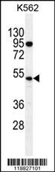 TdT Antibody (C-term)
