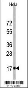 Fagilis (IFITM3) Antibody (Center)
