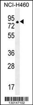 ZNF28 Antibody (N-term)