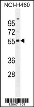 RASSF8 antibody (N-term)