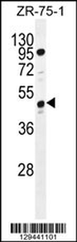 SPMIP7 Antibody (C-term)
