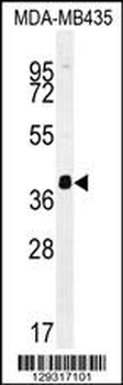HNRNPCL1 Antibody (C-term)