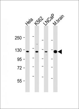 JMJD2C Antibody (C-term)