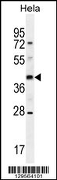 OR10H4 Antibody (C-term)