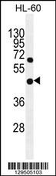 GDPD1 Antibody (N-term)