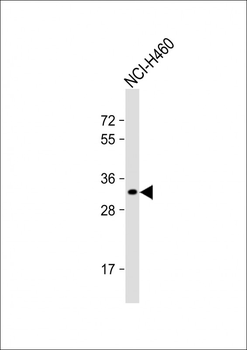 OR2B11 Antibody (C-term)