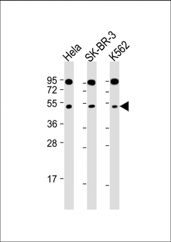 SLC16A13 Antibody (C-term)
