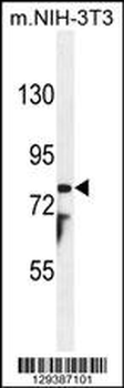 PTCHD1 Antibody (Center)