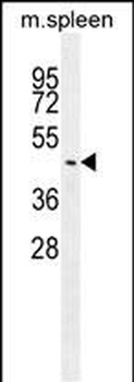 SLC35F3 Antibody (Center)