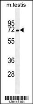 MBTD1 Antibody (C-term)