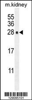 POLR3GL Antibody (Center)