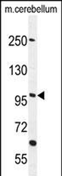 FAM160B1 Antibody (C-term)