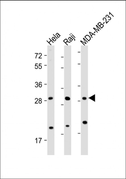 RAB12 Antibody (N-term)