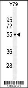 CCDC97 Antibody (C-term)