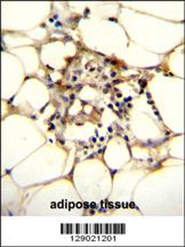 C9JLR9 Antibody (C-term)
