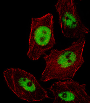 PHOX2B Antibody (Center)