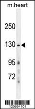 GRIN2A Antibody (Center)