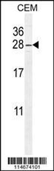 ARL8 Antibody (C-term)