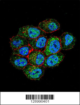 TSPYL6 Antibody (Center)