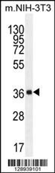 FAM108C1 Antibody (Center)