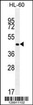 OR2F2 Antibody (C-term)