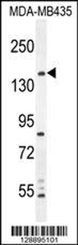 CAMSAP1 Antibody (N-term)