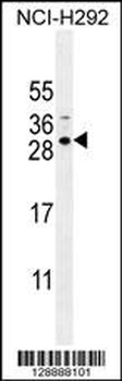 SPACA5B Antibody (N-term)
