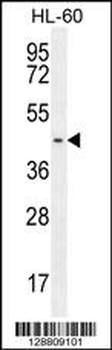 GPR142 Antibody (N-term)