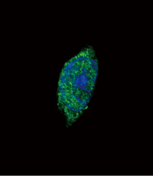 JAK2 Antibody (C-term)