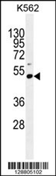 PRAMEF10 Antibody (C-term)